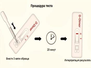 Нормальные значения Д-димера