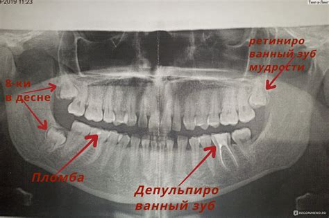 ОПТГ и его особенности