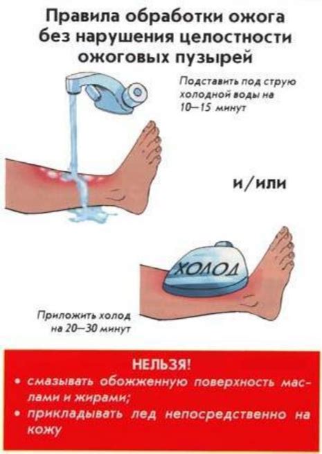 Обработка ожога: основные правила и средства