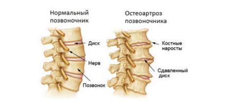 Односторонний дискомфорт