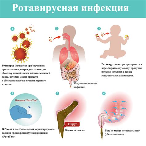 Опасности рвоты при ротавирусной инфекции