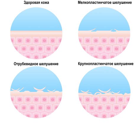 Опасности шелушения кожи и последствия