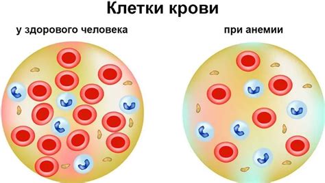 Опасность повышенного гемоглобина для здоровья мужчин