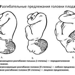 Определение головного положения ребенка