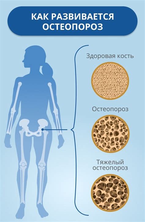 Определение и сущность заболевания