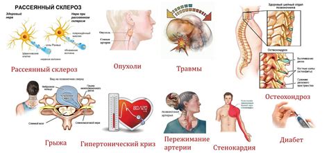 Определение постельного склероза