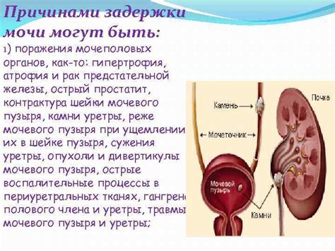 Определенные заболевания мочеполовой системы, вызывающие пенистость мочи у женщин