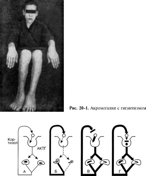 Опухолевые процессы в животе