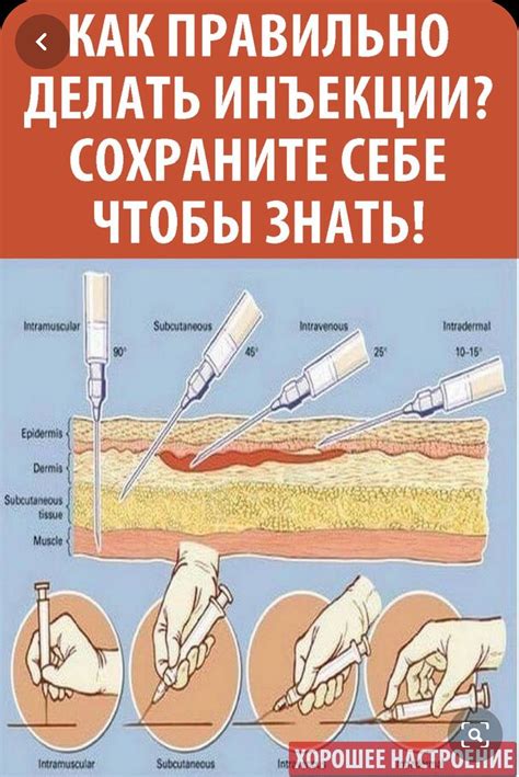 Осложнения воткновения иголки в ногу