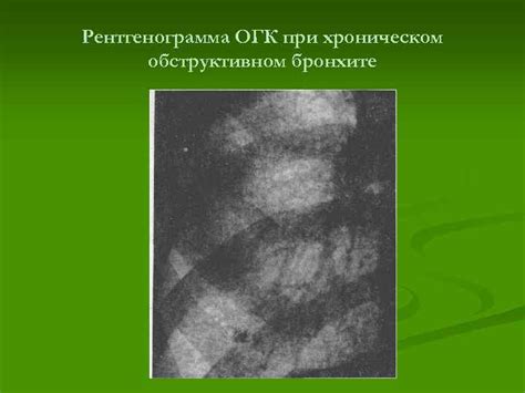 Осложнения при хроническом обструктивном заболевании легких