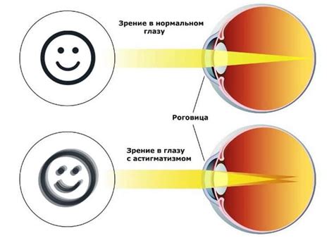 Основные признаки и симптомы теней в поле зрения