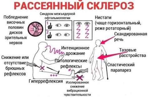 Основные причины нарушения вестибулярного аппарата