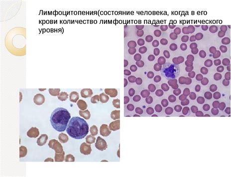 Основные причины понижения лимфоцитов