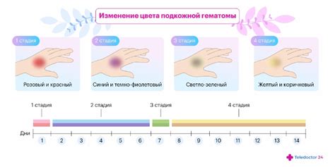 Основные причины синяков