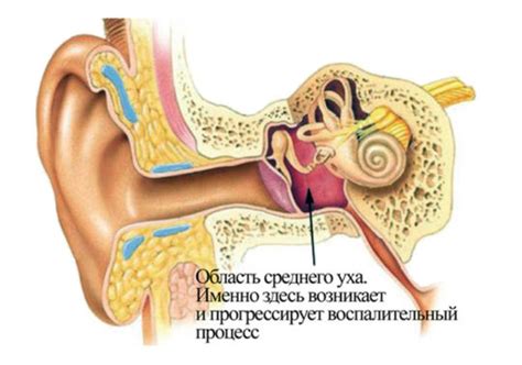 Основные симптомы воспаления среднего уха