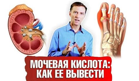 Основные факторы, влияющие на уровень мочевой кислоты в крови