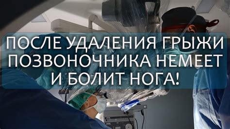 Особенности восстановления после удаления грыжи