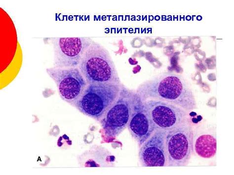 Особенности клеток метаплазированного эпителия