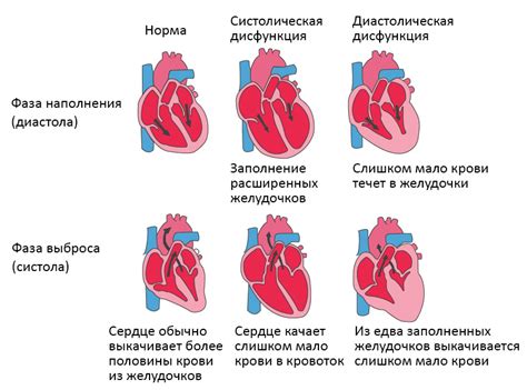 Острая недостаточность кровообращения