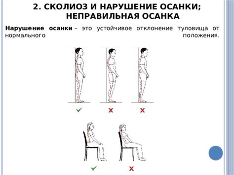 Отклонение от нормального положения