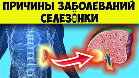 От чего может разорваться селезенка?