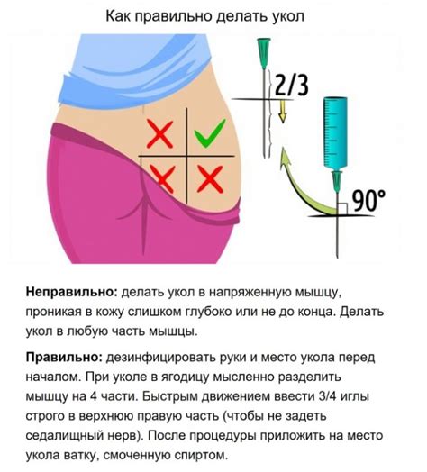 Ошибочный укол в ягодицу: последствия и проблемы