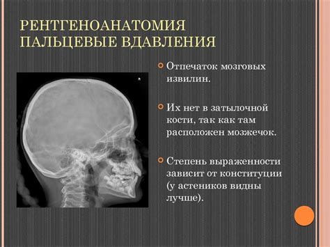 Пальцевые вдавления черепа на рентгене: причины, симптомы, лечение