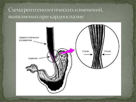 Патологии пищеварительной системы