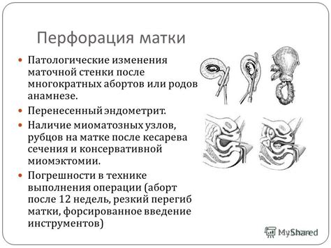 Патологические изменения в матке