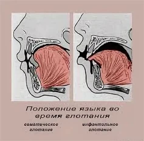 Патологические процессы при глотании гнойного скопления