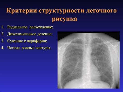 Патологические состояния, сопровождающие усиление легочного рисунка в прикорневой зоне