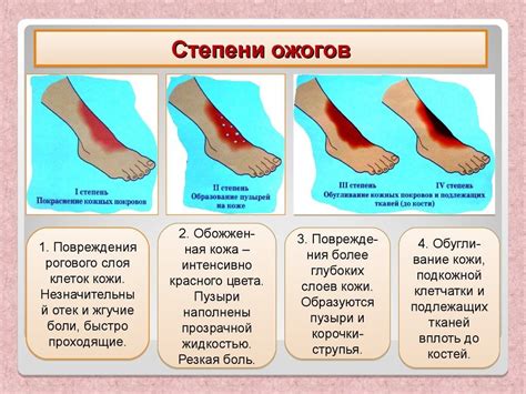 Первая помощь при ожоге: что нельзя делать?