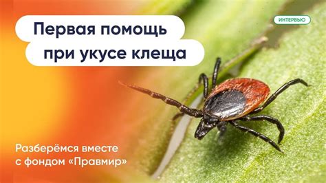 Первая помощь при укусе клеща