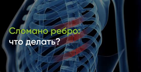 Перелом ребра: как его определить и что делать