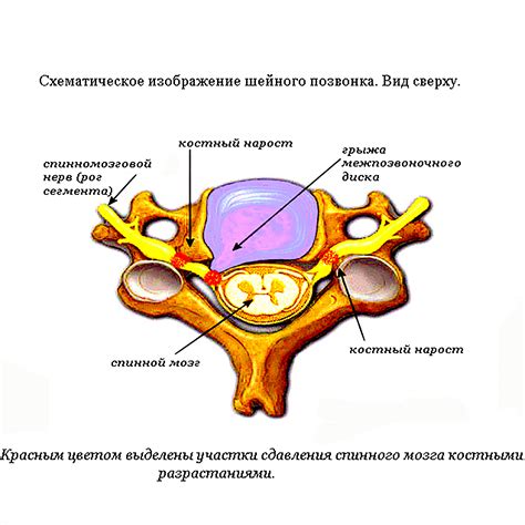 Перемещение шейных позвонков