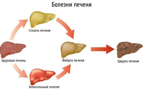 Печень – основной фильтр организма