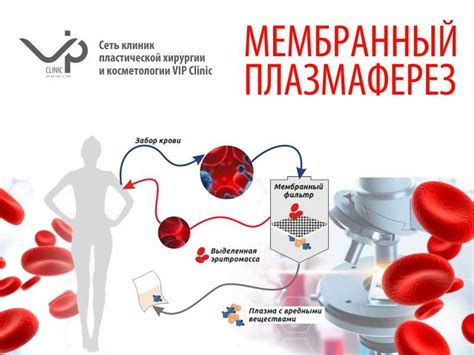 Плазмаферез: суть процедуры и ее роль в очистке организма