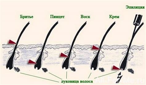 Повреждение кожи при выщипывании волос