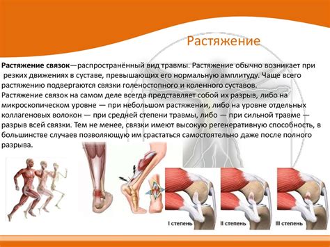 Повреждение связок при травме: что делать в экстренной ситуации?