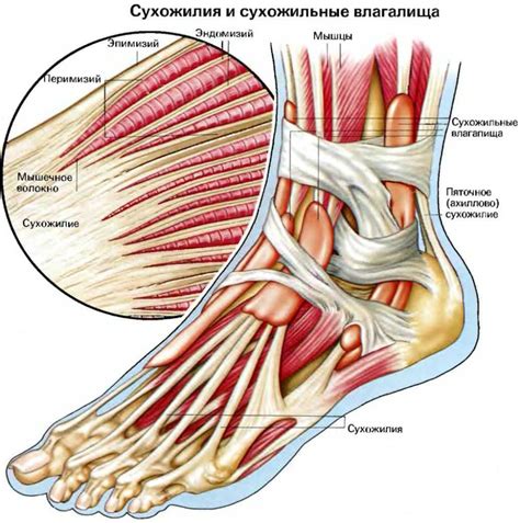 Повреждение сухожилий: причины и последствия