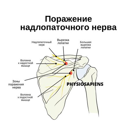 Повышение конечности