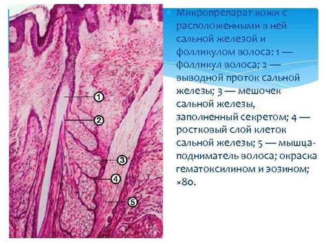 Повышенная активность потовых желез