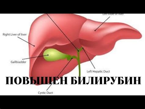 Повышенный прямой билирубин в крови: причины и симптомы