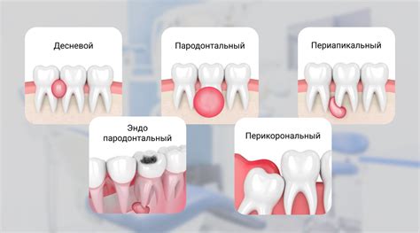 Подозрения на нарыв: как их распознать