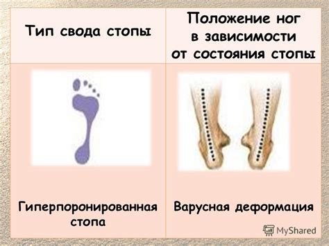 Положение ног: показатель эмоционального состояния