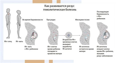 Положительный резус: особенности и распространение