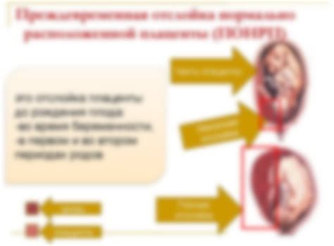 Помощь при выделении плаценты