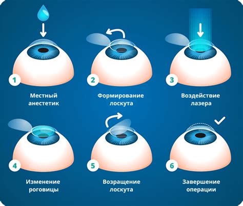 Посещение специалиста для коррекции зрения