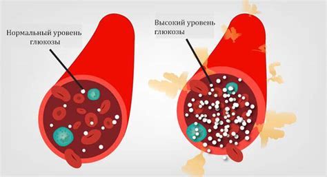 Последствия отсутствия глюкозы в моче