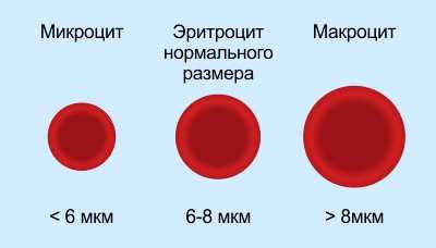 Последствия пониженного RDW у женщин